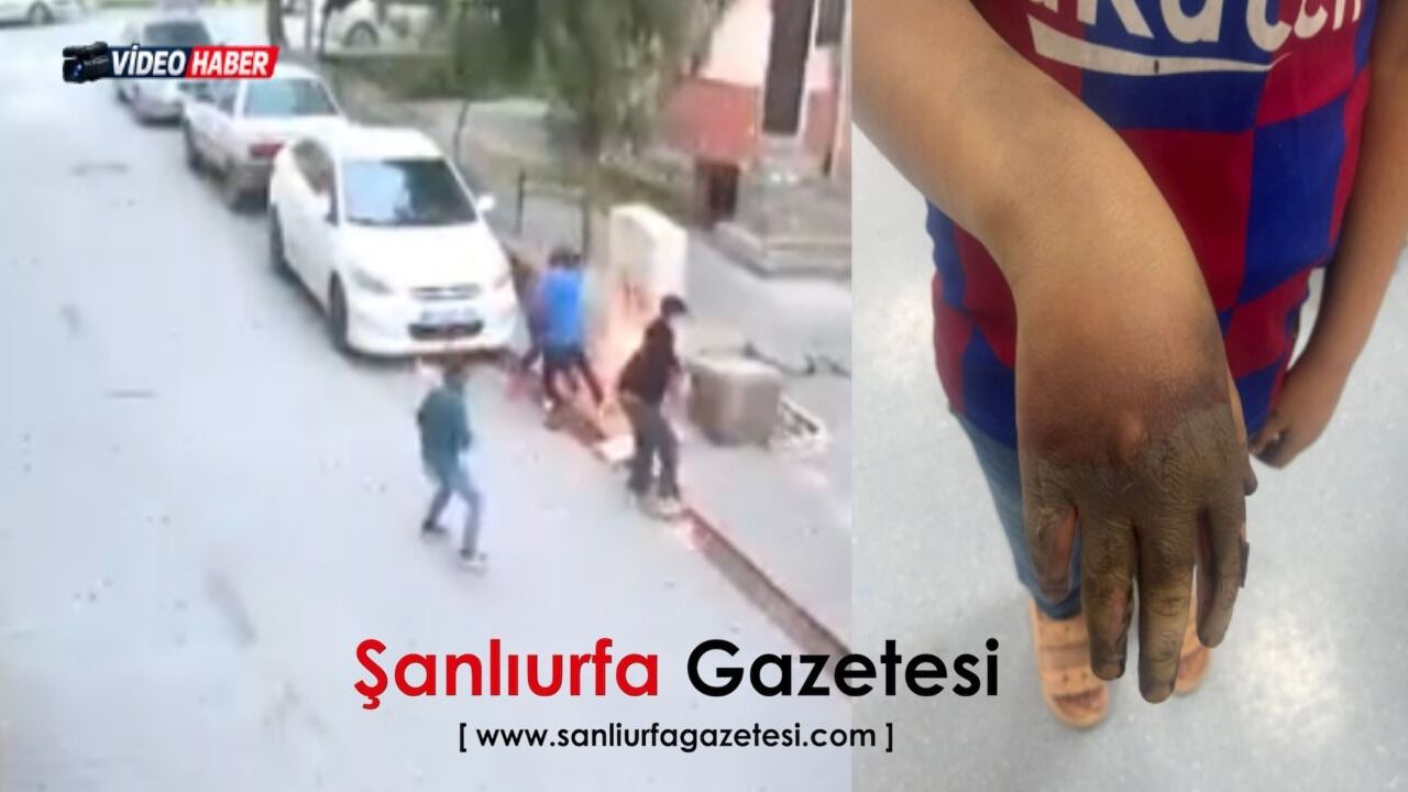 Viranşehir’de elektrik panosu dehşeti 1 çocuk yaralandı