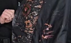 Saraçhane’de Gerilim: Polis Memuruna Asitli Saldırı!