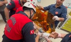 Şanlıurfa'da İnşaatta Feci Kaza: Kaynakçının Koluna Demir Saplandı