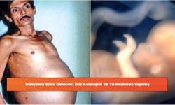 Dünyanın Sonu Gelecek: İkiz Kardeşini 36 Yıl Karnında Taşımış