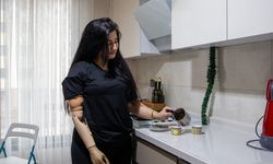 Depremde Kolunu ve Bacağını Kaybetti, Umudunu Kaybetmedi