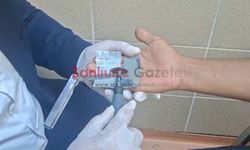 Şanlıurfa’da bir garip olay; Ekip yangında, amir hastanede can kurtardı!