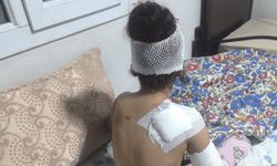 Şanlıurfa’da başıboş köpek küçük çocuğu yaraladı: 150 dikiş atıldı!
