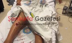 Şanlıurfa'da Sahipsiz Köpek Dehşeti: 6 Yaşındaki Çocuk Hastanelik Oldu