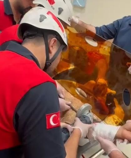 Şanlıurfa'da İnşaatta Feci Kaza: Kaynakçının Koluna Demir Saplandı