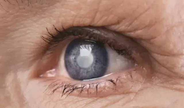 Katarakt Körlüğün En Büyük Nedeni Mi?