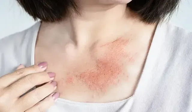 Kış Aylarında D Vitamini Eksikliği Neden Artıyor? Uzman Uyardı!