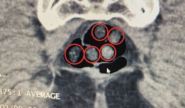 Bitlis Tatvan’da Otobüs ve Araçta Metamfetamin Ele Geçirildi!