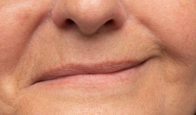 Soğuk Havalarda Yüz Felcinden Korunmanın 5 Yolu!