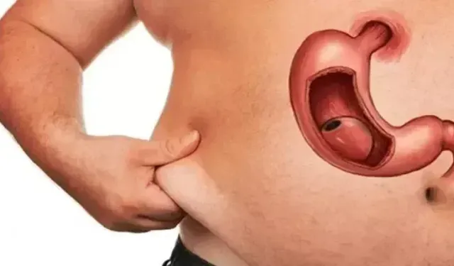 Mide Kanserinde Erken Teşhis Neden Hayat Kurtarıyor!