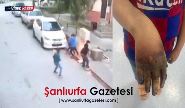 Viranşehir’de elektrik panosu dehşeti 1 çocuk yaralandı