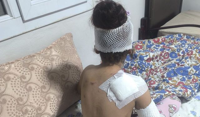 Şanlıurfa’da başıboş köpek küçük çocuğu yaraladı: 150 dikiş atıldı!