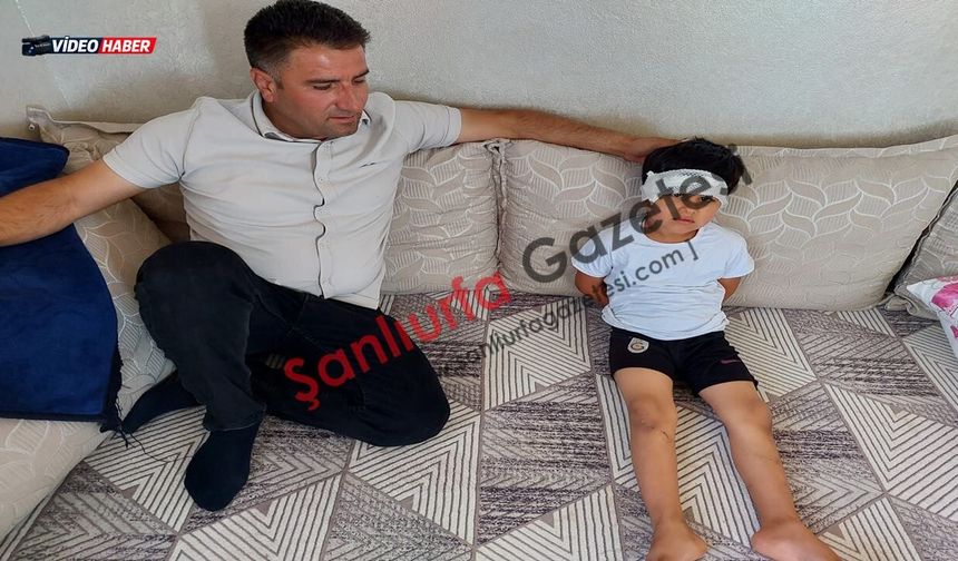 Şanlıurfa Viranşehir'de köpek saldırısına uğrayan çocuktan iyi haber geldi
