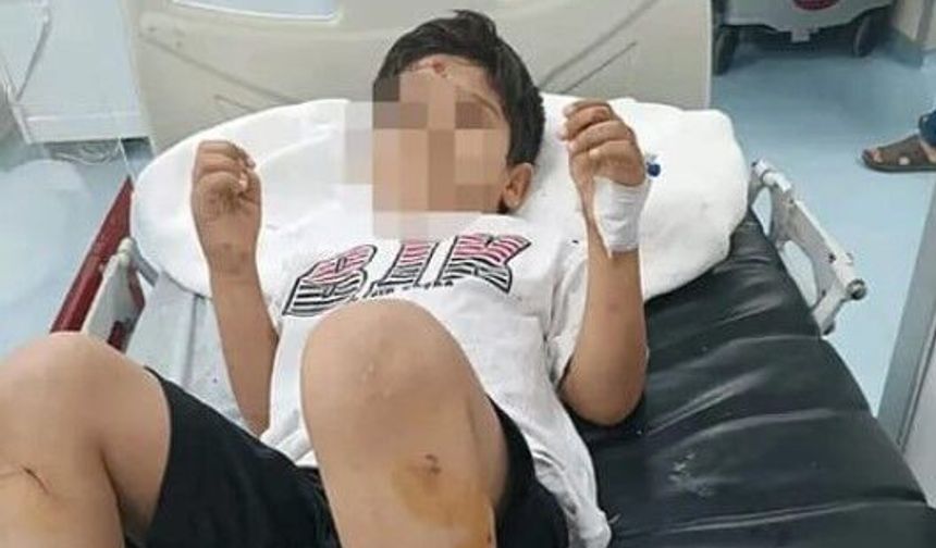 Şanlıurfa Viranşehir’de başıboş köpek krizi: Bakanlık müfettiş görevlendirdi