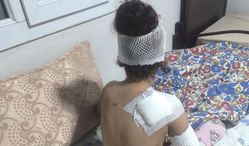 Şanlıurfa’da başıboş köpek küçük çocuğu yaraladı: 150 dikiş atıldı!