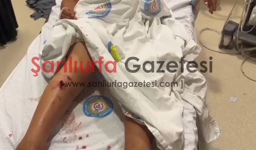 Şanlıurfa'da Sahipsiz Köpek Dehşeti: 6 Yaşındaki Çocuk Hastanelik Oldu