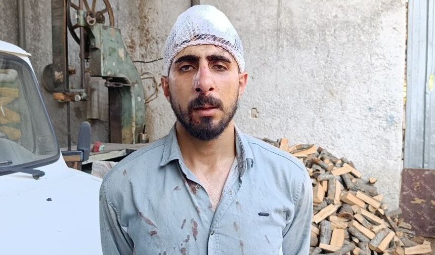 Şanlıurfa’da “Yavaş Gidiyordu” İddiası Ortalığı Karıştırdı: Burnu Kırıldı, 8 Dikiş Atıldı