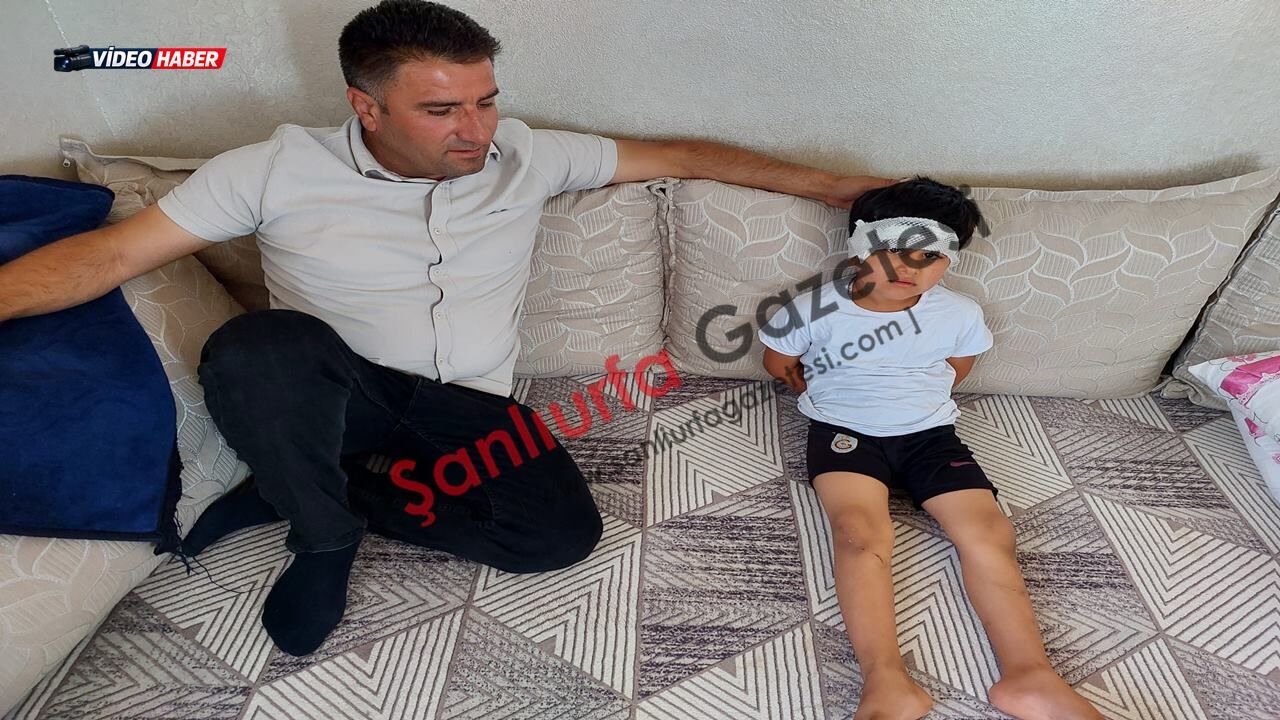 Şanlıurfa Viranşehir'de köpek saldırısına uğrayan çocuktan iyi haber geldi