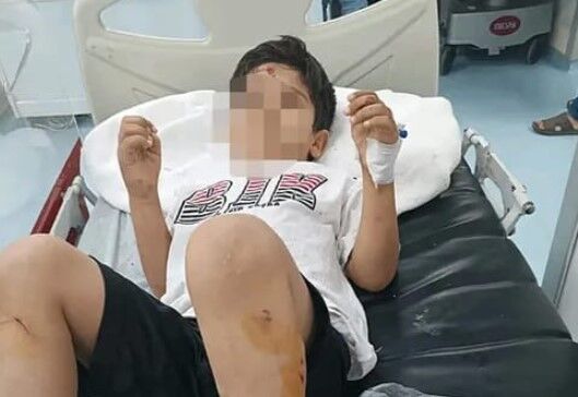 Şanlıurfa Viranşehir’de başıboş köpek krizi: Bakanlık müfettiş görevlendirdi
