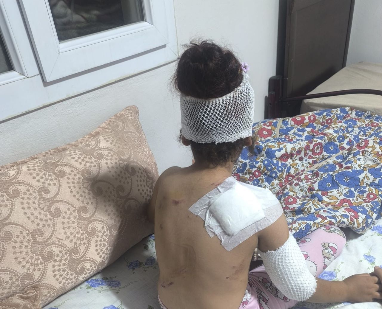 Şanlıurfa’da başıboş köpek küçük çocuğu yaraladı: 150 dikiş atıldı!