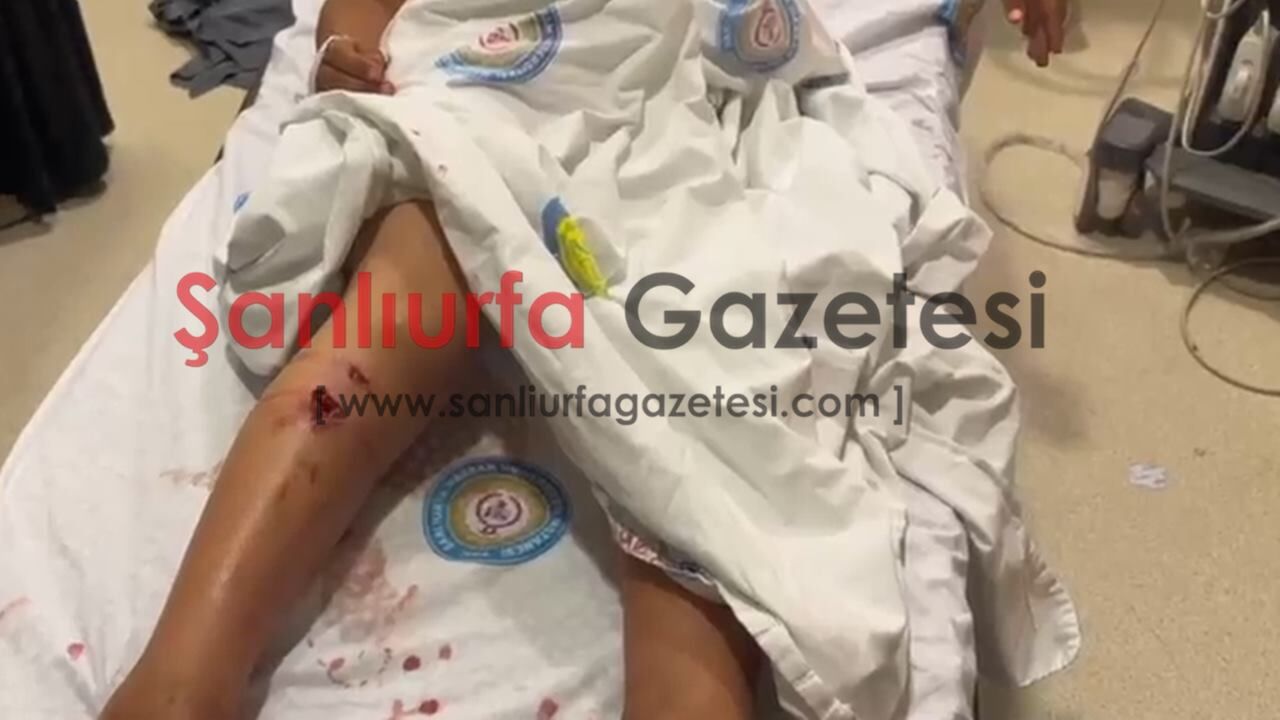Şanlıurfa'da Sahipsiz Köpek Dehşeti: 6 Yaşındaki Çocuk Hastanelik Oldu