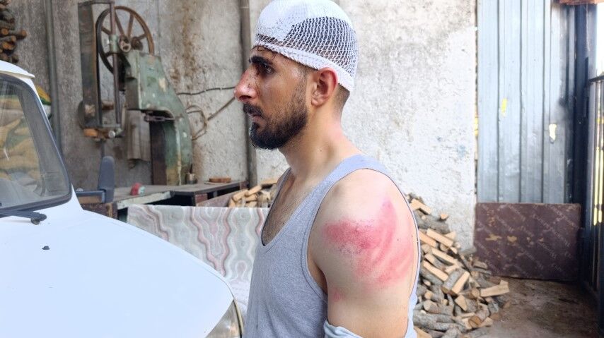 Şanlıurfa’da “Yavaş Gidiyordu” İddiası Ortalığı Karıştırdı Burnu Kırıldı, 8 Dikiş Atıldı (1)