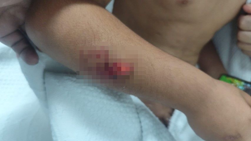 Şanlıurfa’da Korkutan Olay Köpeklerin Saldırdığı Çocuğun Başına 15 Dikiş Atıldı (1)