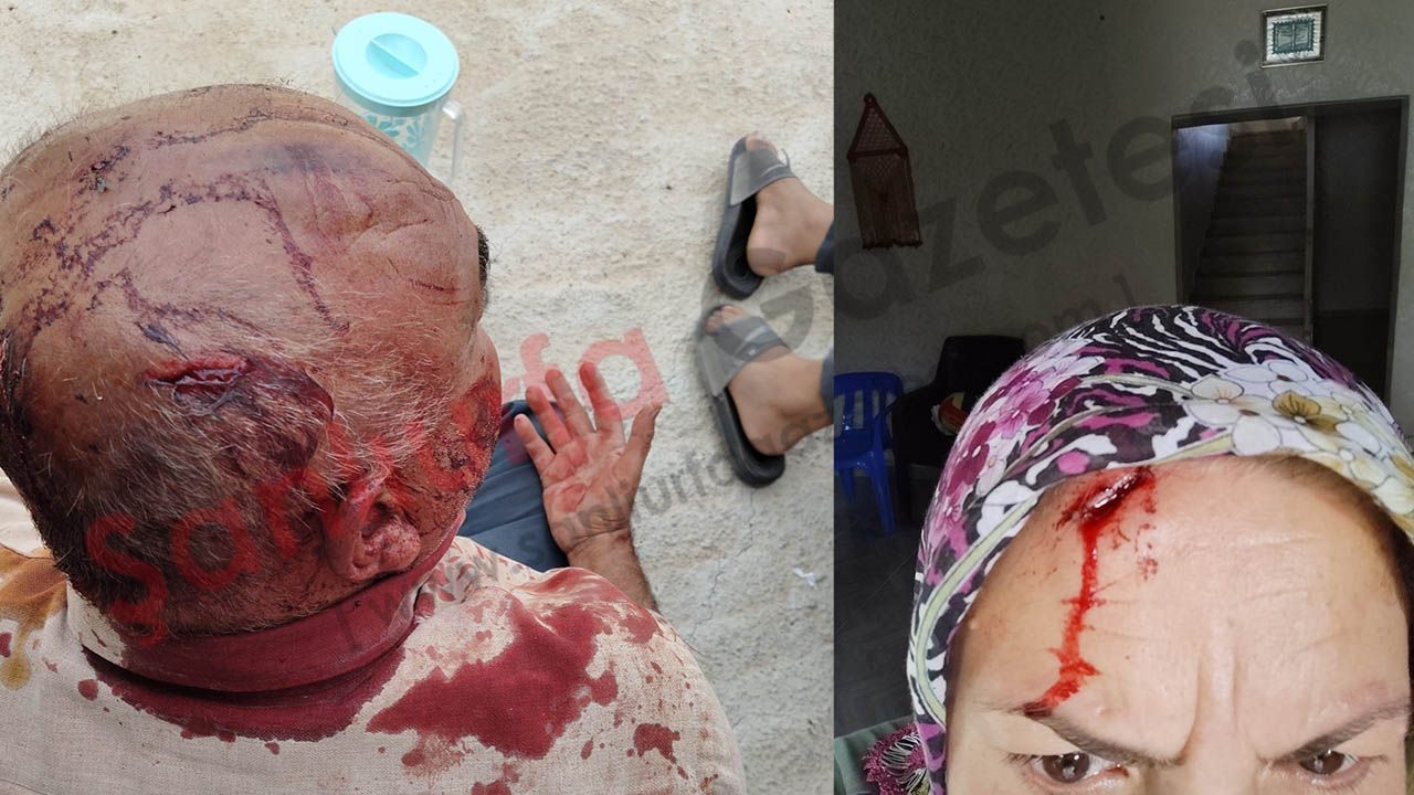 Şanlıurfa’da taşlı ve sopalı kavga: Yaralılar var!